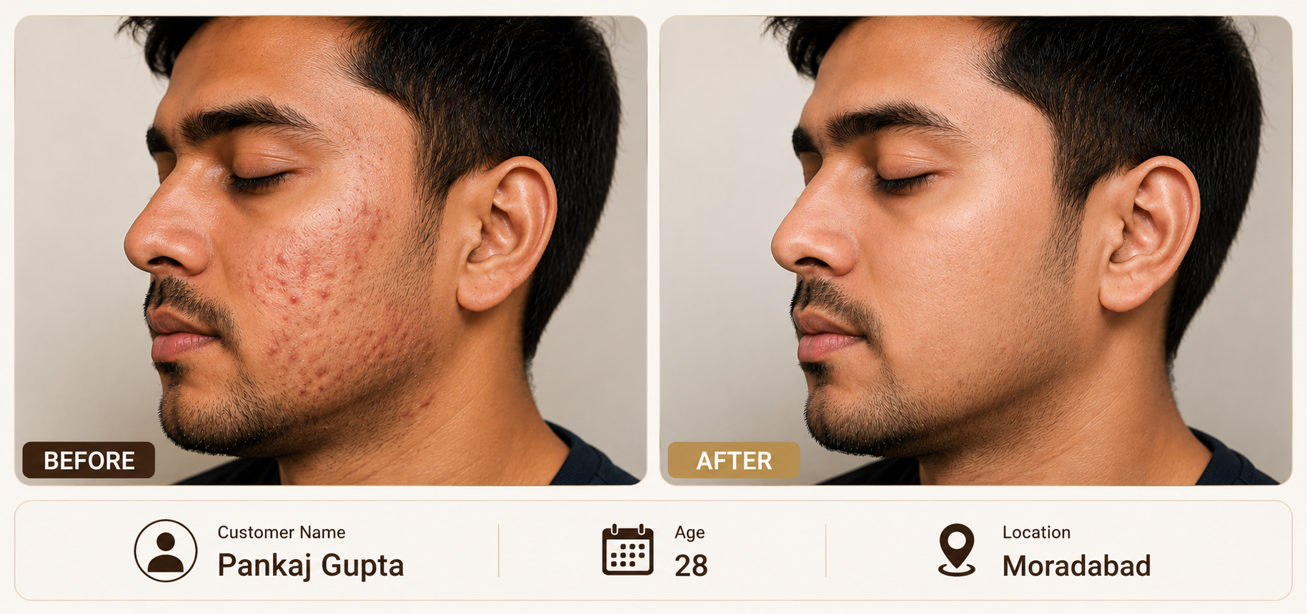 KEYDERMA