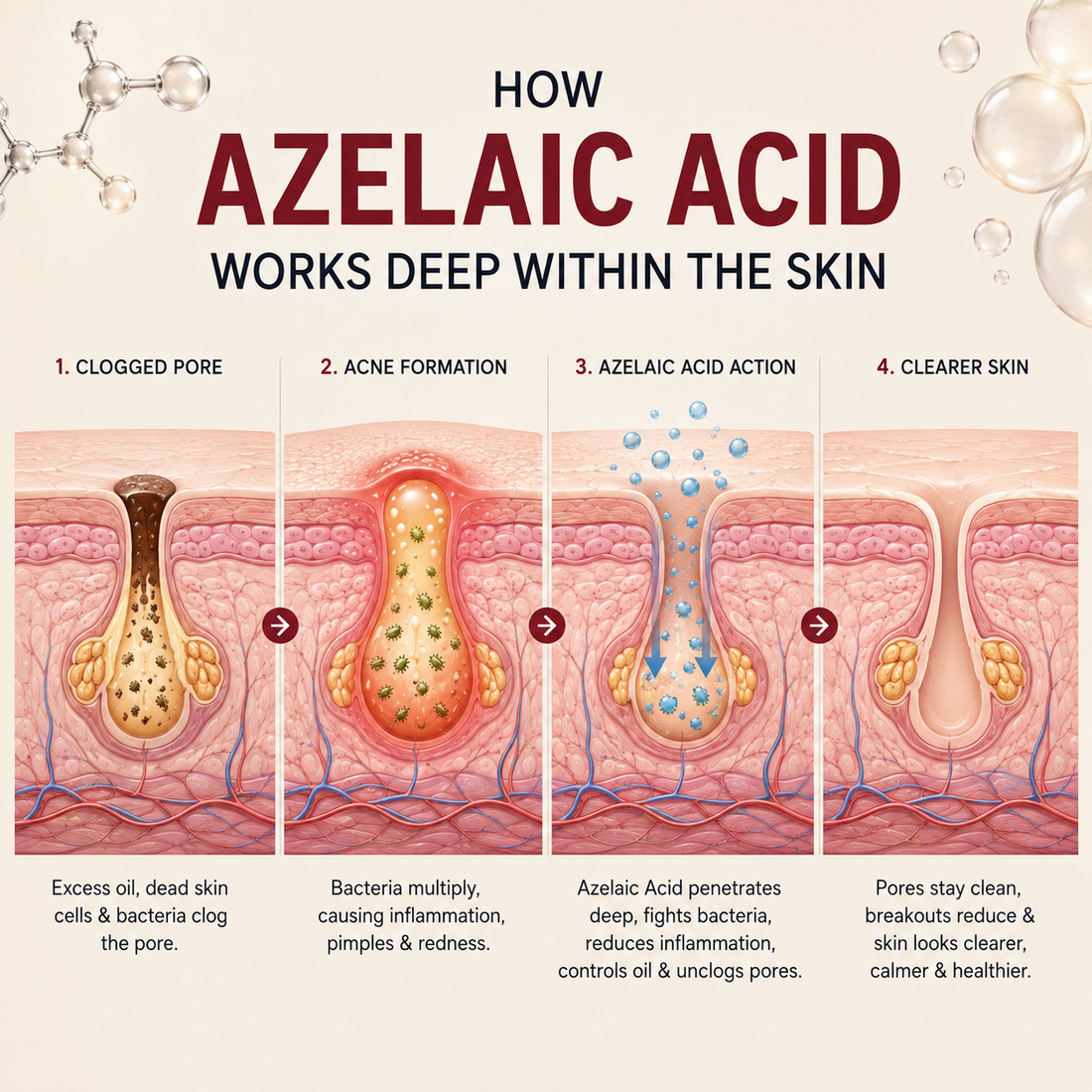 10% Azelaic Acid