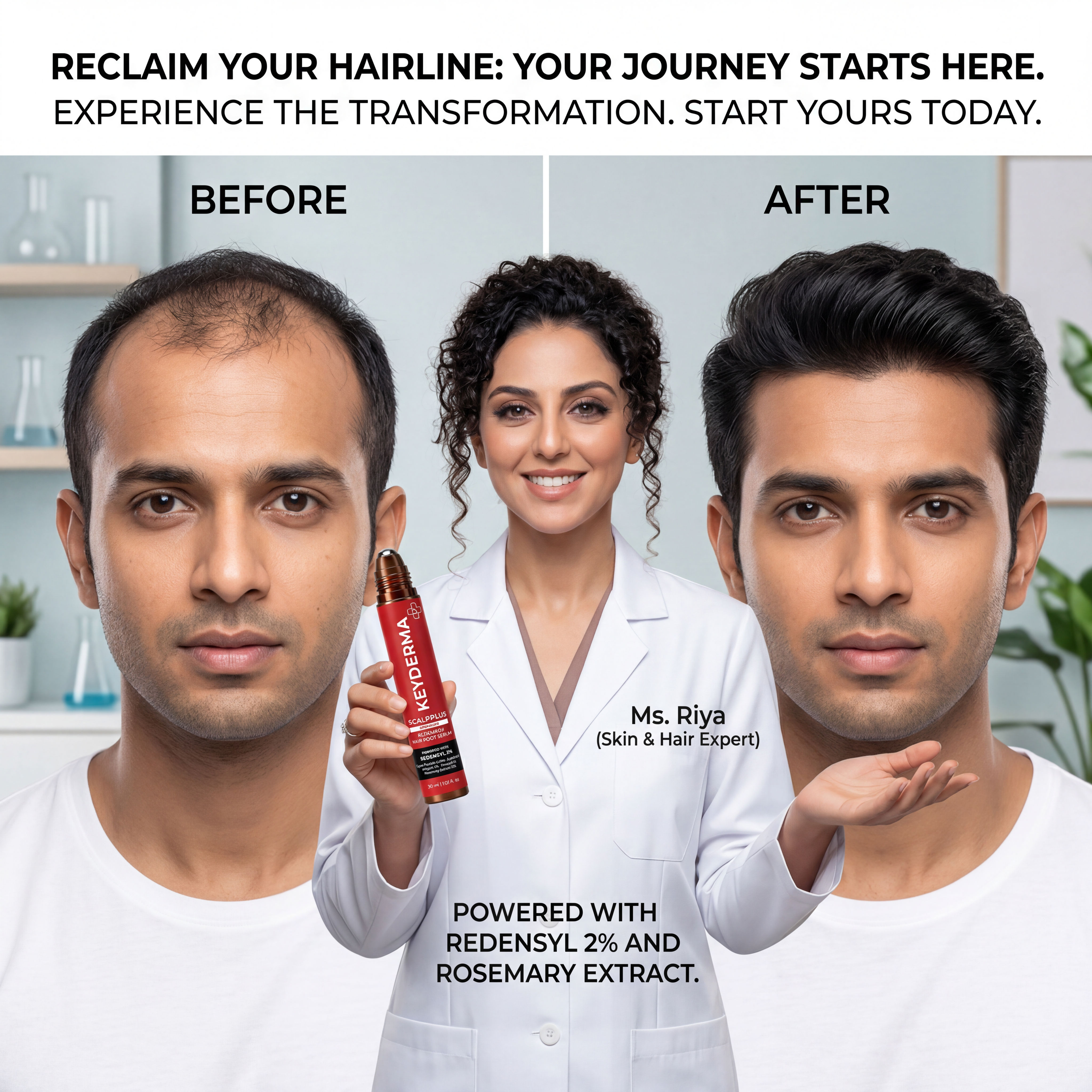 ScalpPlus Advanced Rosemary Hair Root Serum (30ml)