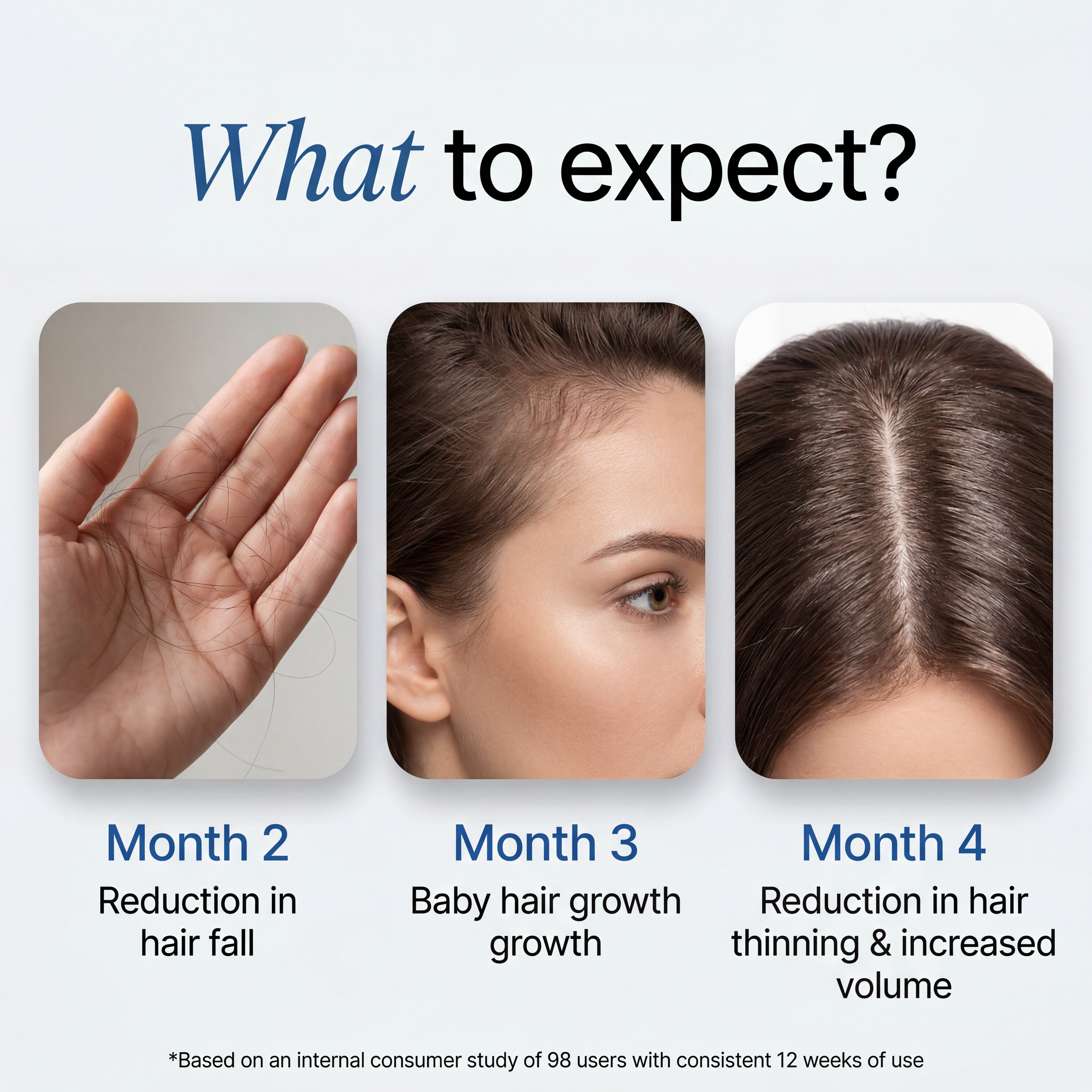 ScalpPlus Advanced Rosemary Hair Root Serum (30ml)