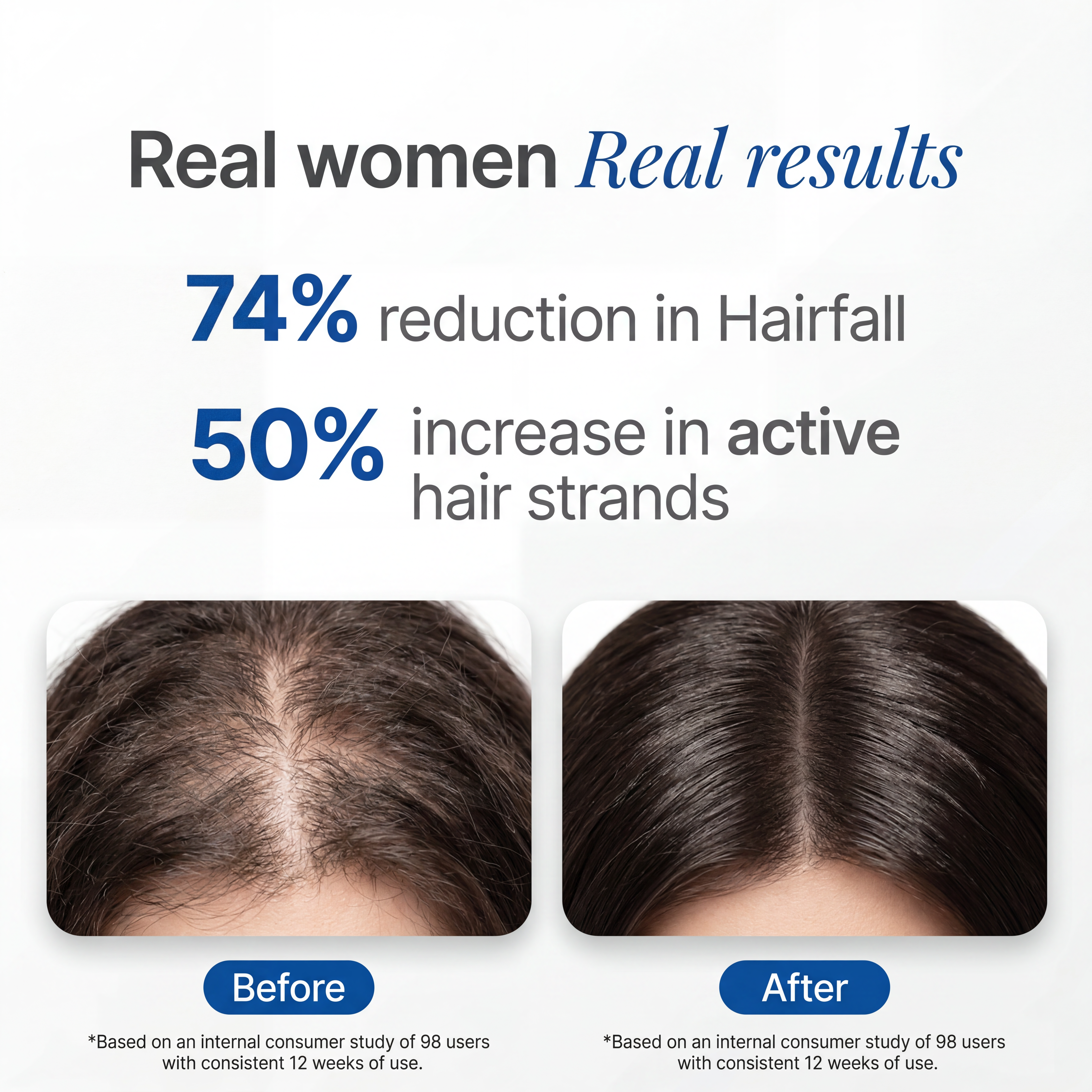ScalpPlus Advanced Rosemary Hair Root Serum (30ml)