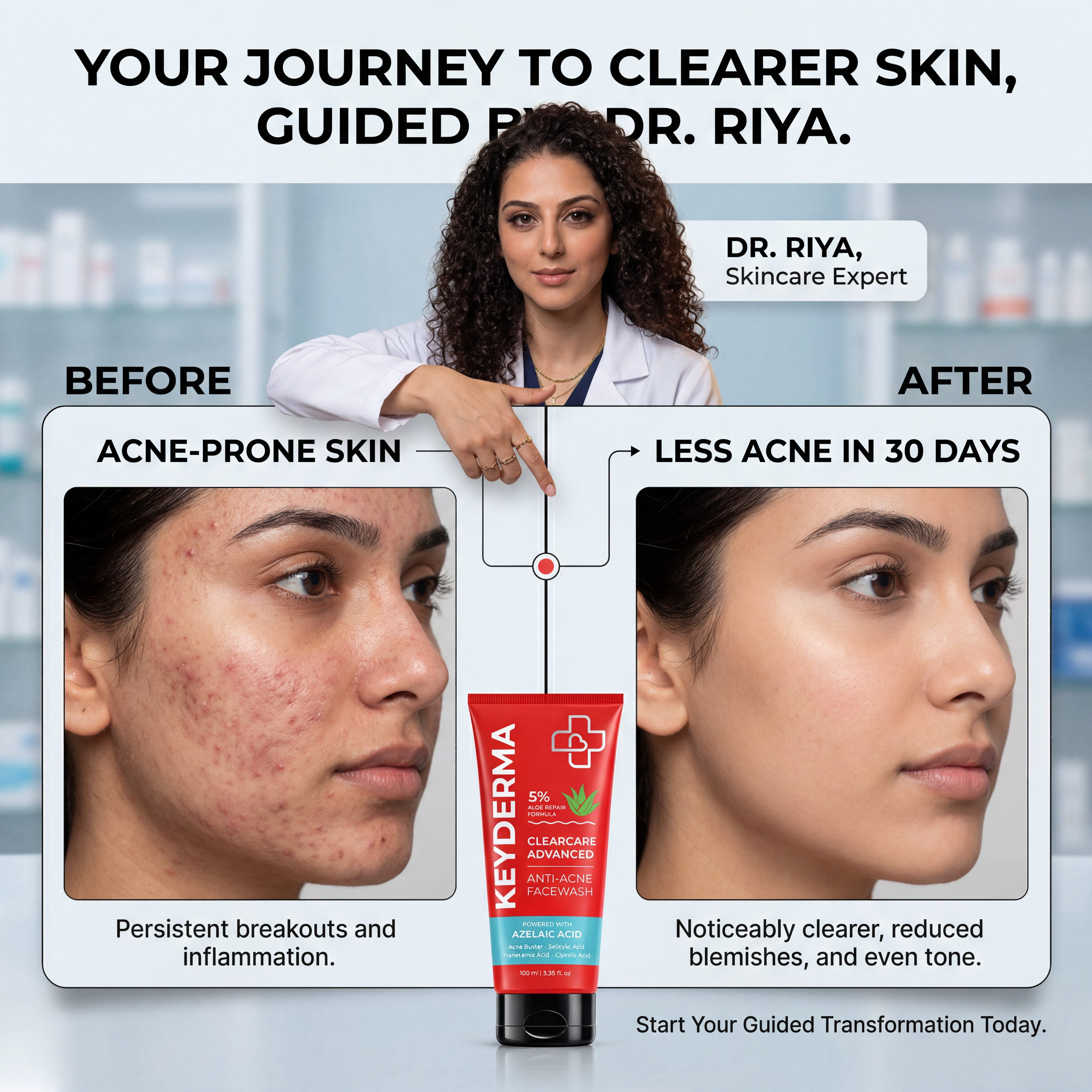 CleanCare Advanced Anti-Acne Face Wash (100ml)