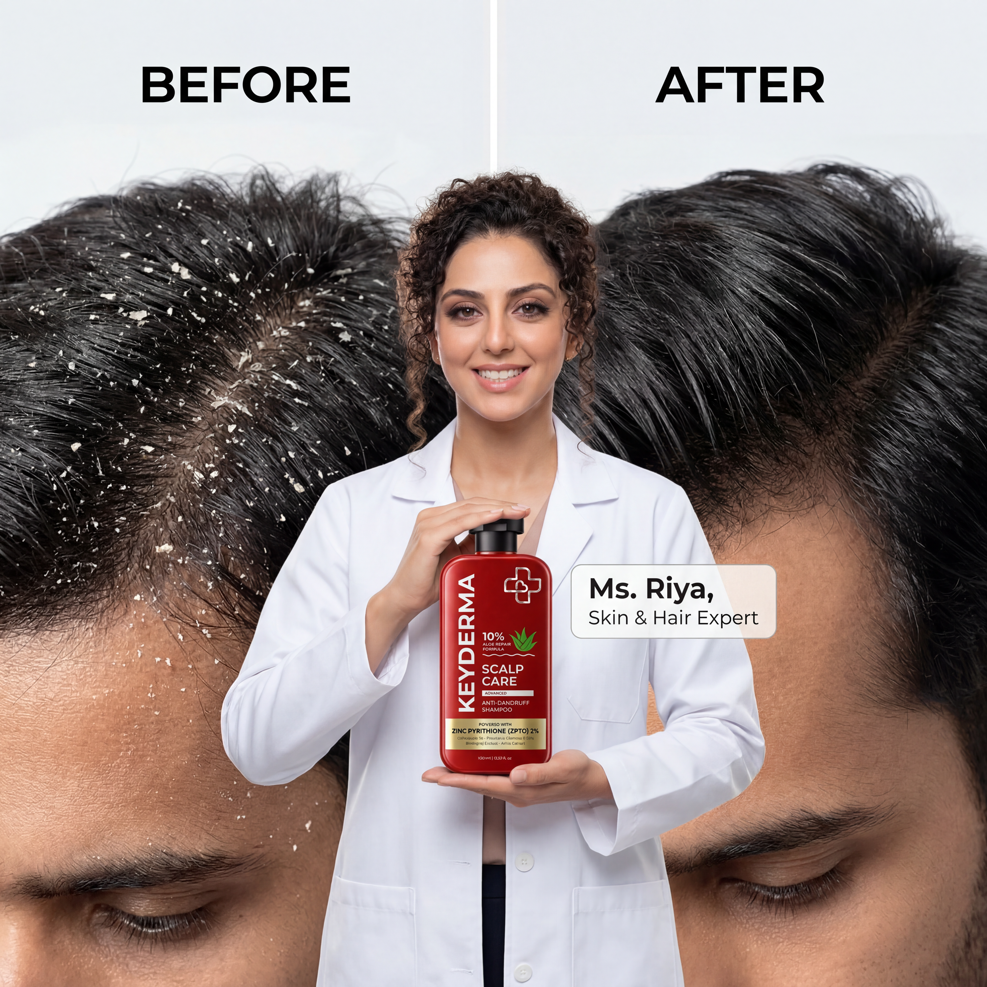 ScalpCare Advanced Anti-Dandruff Shampoo (400ml)
