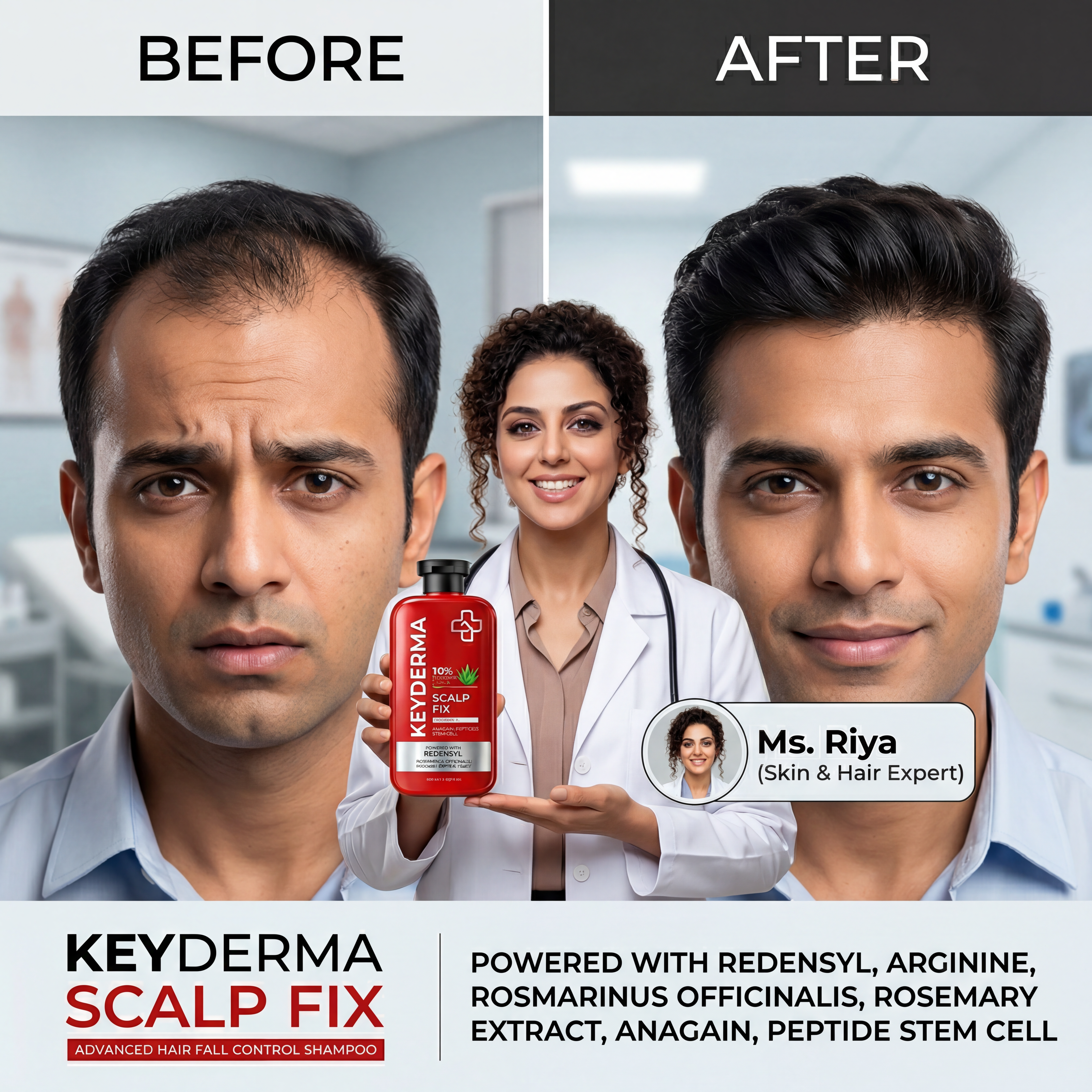 ScalpFix Advanced Anti Hair Fall Control Shampoo (400ml)