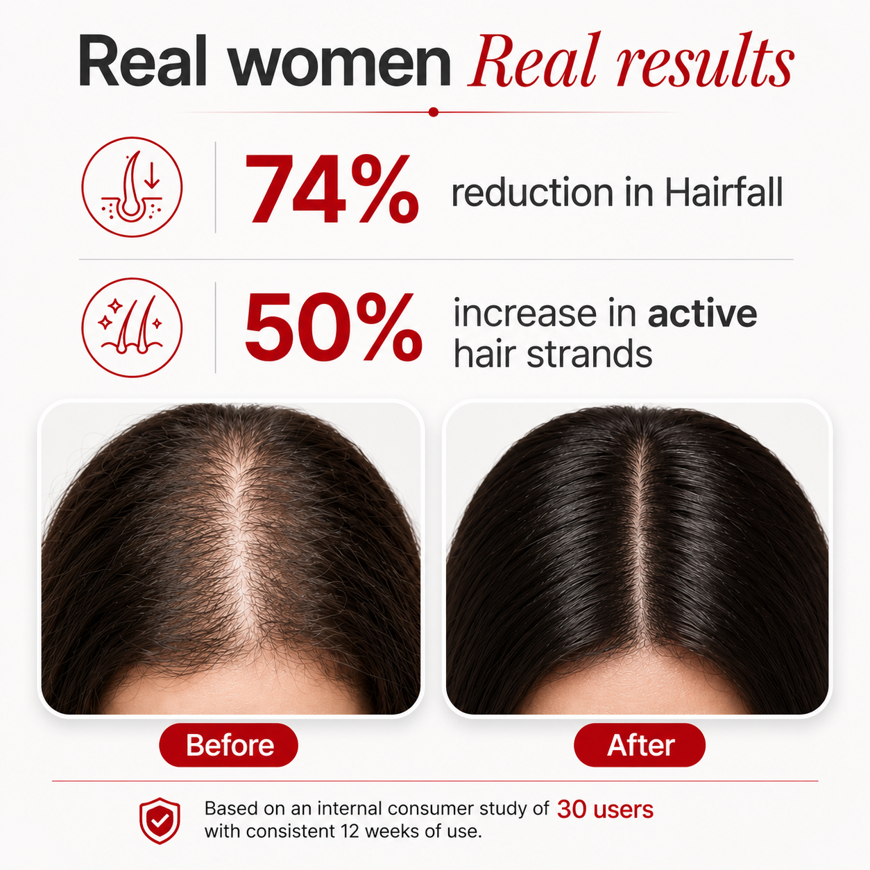 ScalpPlus Advanced Rosemary Hair Root Serum (30ml)