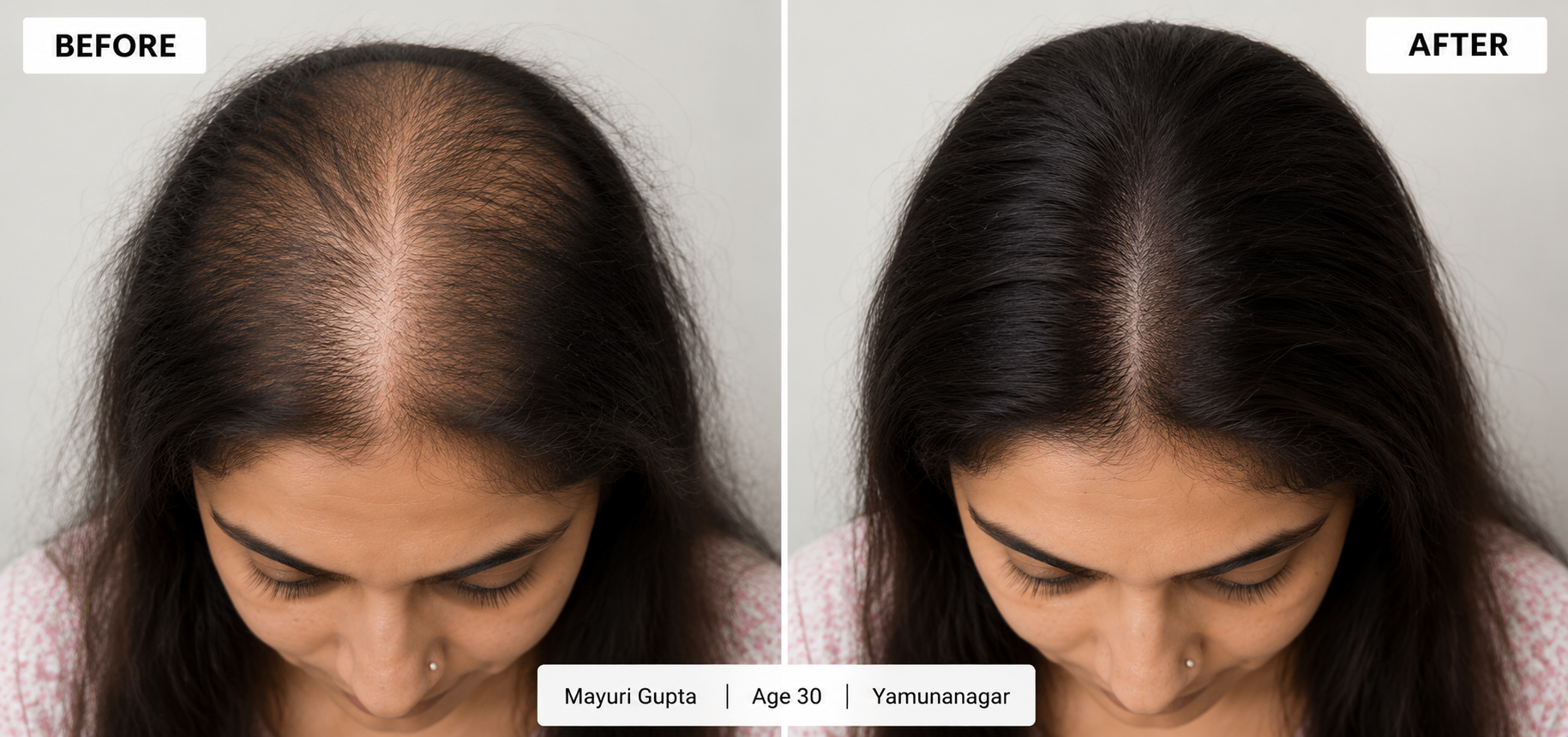 KEYDERMA