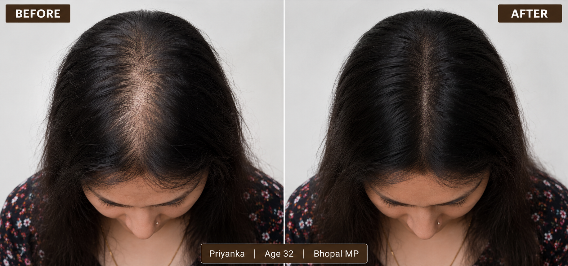 KEYDERMA
